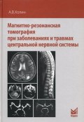Магнитно-резонансная томография при заболеваниях и травмах центральной нервной системы (, 2017)