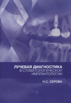 Книга "Лучевая диагностика в стоматологической имплантологии" – , 2015