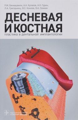 Книга "Десневая и костная пластика в дентальной имплантологии" – , 2017