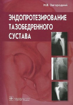 Книга "Эндопротезирование тазобедренного сустава. Основы и практика. Руководство" – , 2013