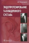 Эндопротезирование тазобедренного сустава. Основы и практика. Руководство (, 2013)