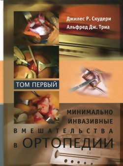 Книга "Минимально инвазивные вмешательства в ортопедии. В 2 томах. Том 1" – , 2014