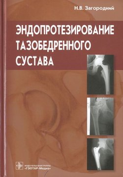 Книга "Эндопротезирование тазобедренного сустава" – , 2012