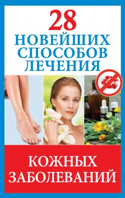 Книга "28 новейших способов лечения кожных заболеваний" {Новейшие способы лечения} – Полина Голицына, 2013