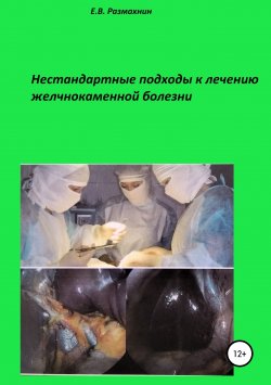 Книга "Нестандартные подходы к лечению желчнокаменной болезни" – Евгений Размахнин, 2017